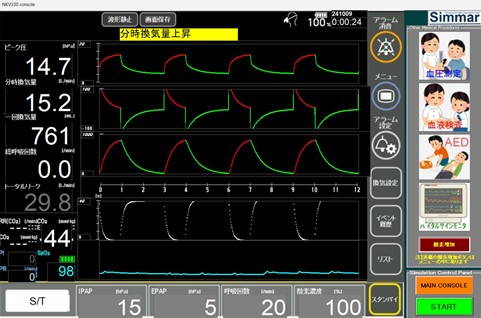 図2. 人工呼吸器トレーニングアプリSimmar