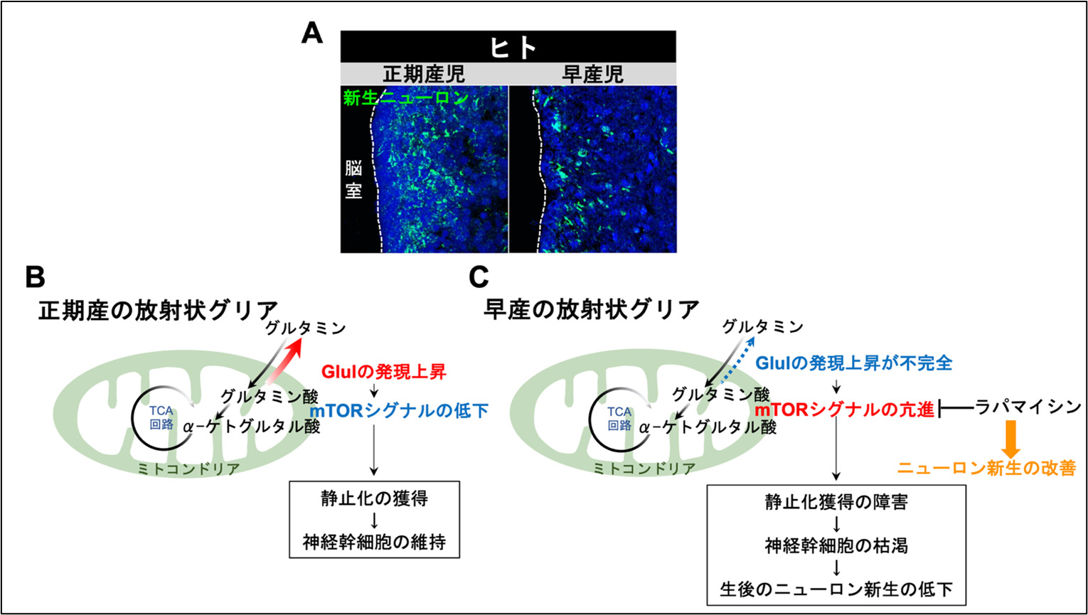 「生まれる」ことで脳が発達する～早産児脳障害の病態メカニズムが明らかに～